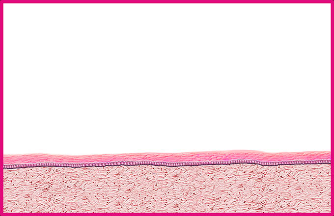 vaginal epidermis W O estrogen base